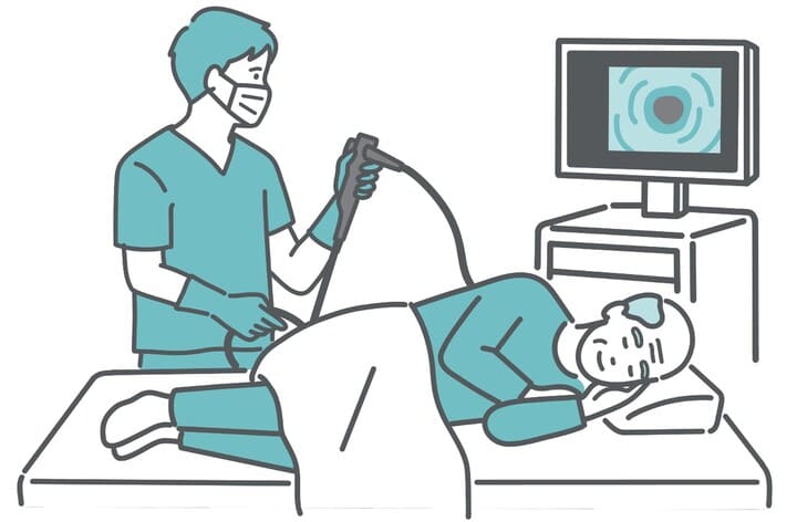 内視鏡検査しているイラスト