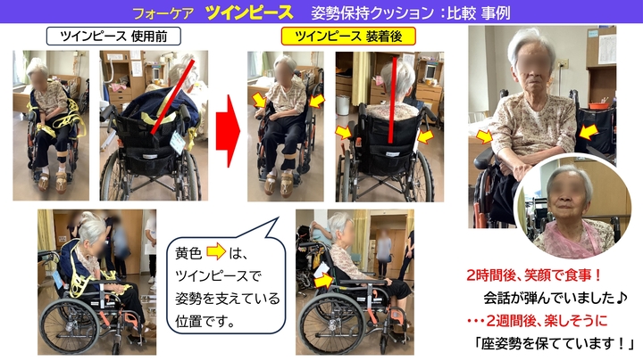 フォーケアツインピース®姿勢保持クッション 使用前後比較画像