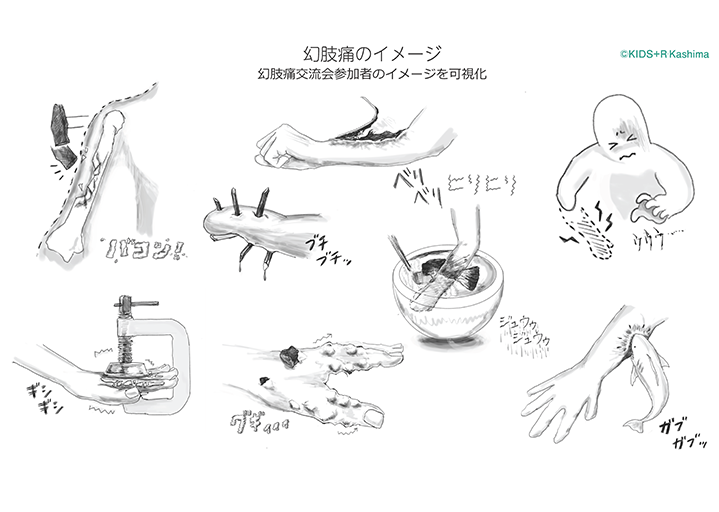 幻肢痛のイメージイラスト