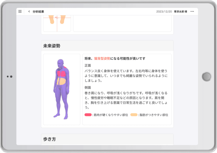 カルティ シセイカルテ分析結果画像